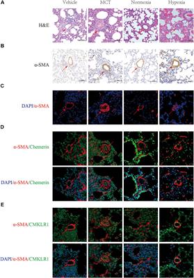 Chemerin Regulates the Proliferation and Migration of Pulmonary Arterial Smooth Muscle Cells via the ERK1/2 Signaling Pathway